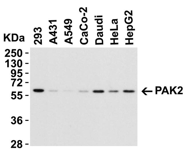 PAK2 Antibody in Western Blot (WB)