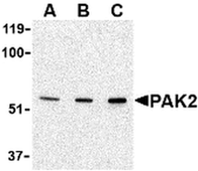 PAK2 Antibody in Western Blot (WB)