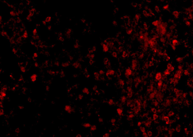 TRPC6 Antibody in Immunocytochemistry (ICC/IF)