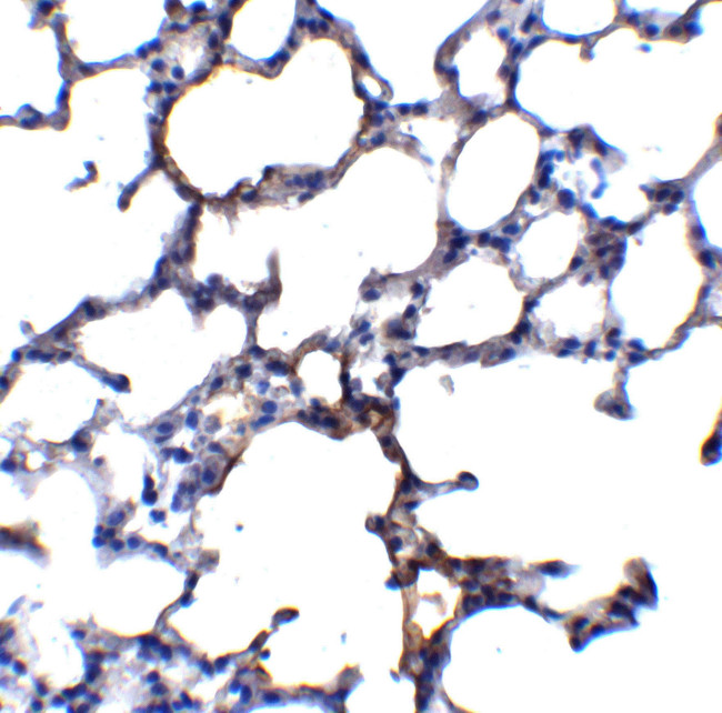 TRPC6 Antibody in Immunohistochemistry (IHC)