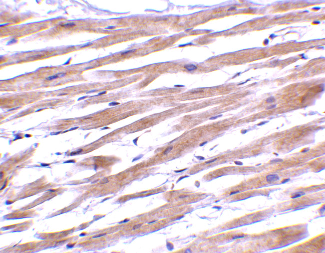 UNG Antibody in Immunohistochemistry (Paraffin) (IHC (P))