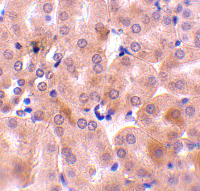 BCL2A1 Antibody in Immunohistochemistry (IHC)