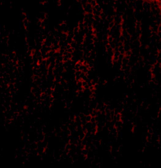 TANK Antibody in Immunocytochemistry (ICC/IF)