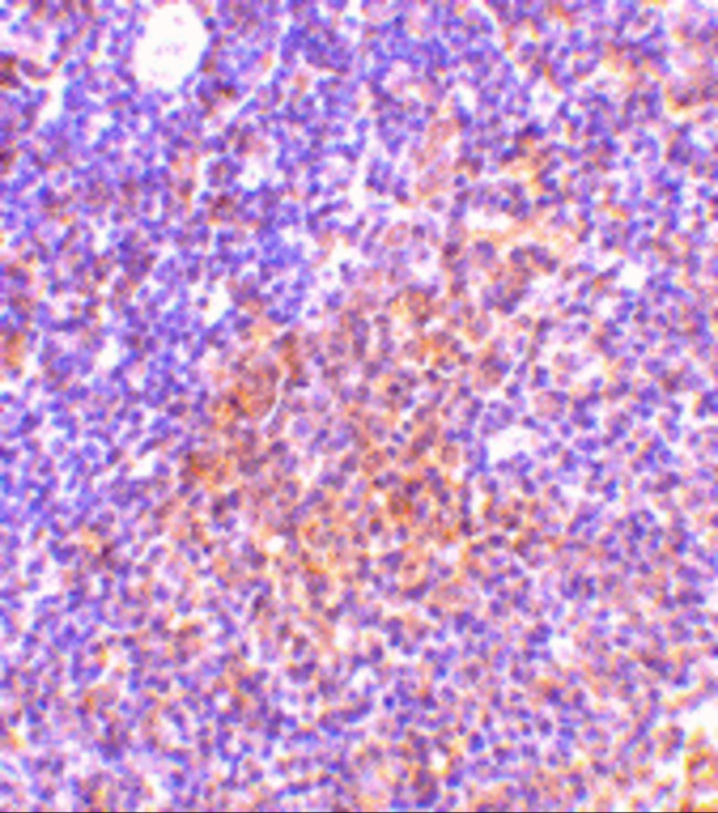 TANK Antibody in Immunohistochemistry (IHC)