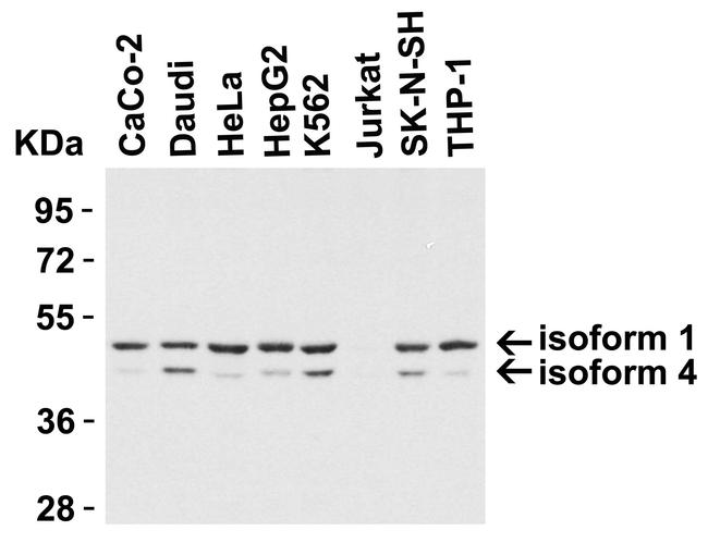 TIP47 Antibody in Western Blot (WB)