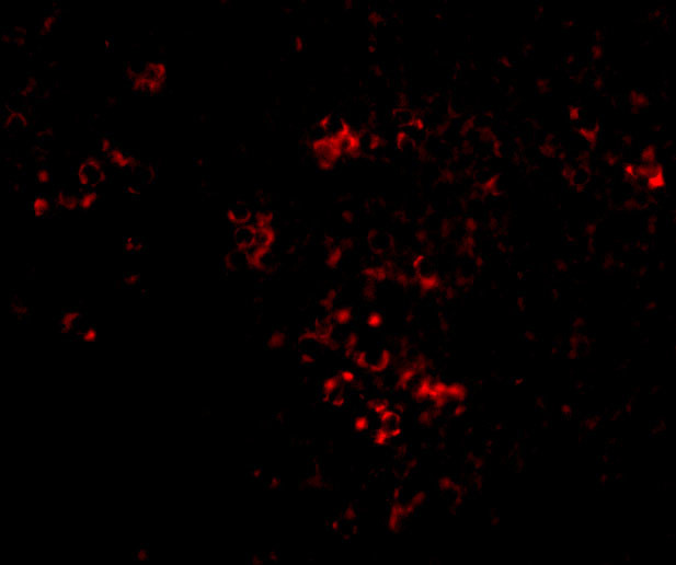 PAK2 Antibody in Immunocytochemistry (ICC/IF)