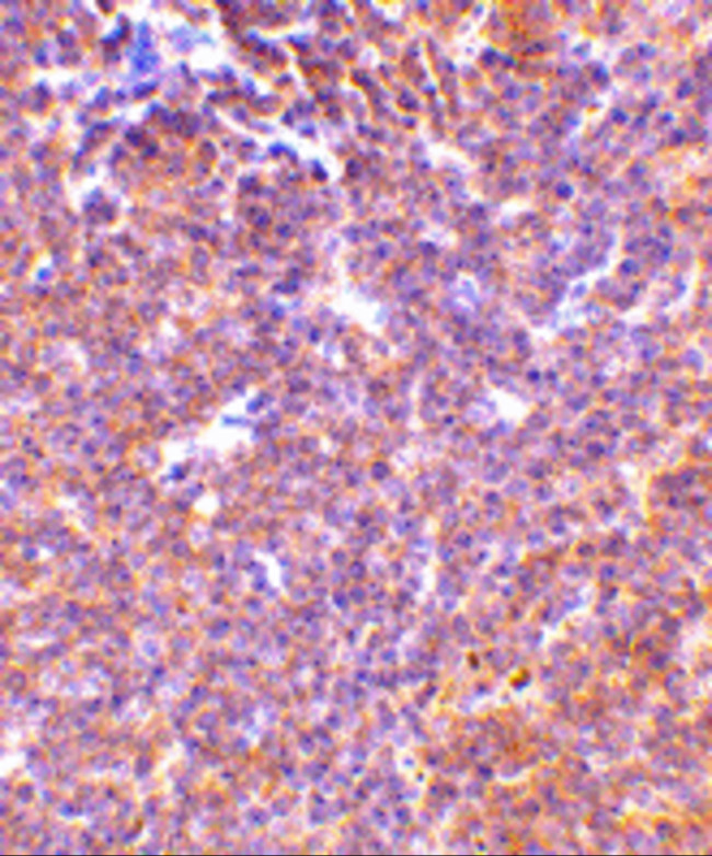 PAK2 Antibody in Immunohistochemistry (Paraffin) (IHC (P))