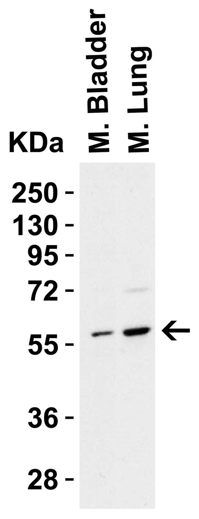 PAK2 Antibody in Western Blot (WB)