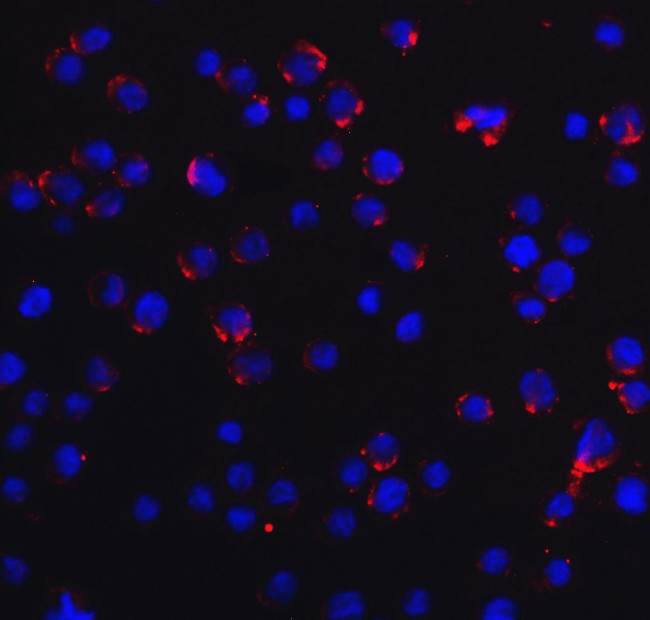 RIG-I Antibody in Immunocytochemistry (ICC/IF)