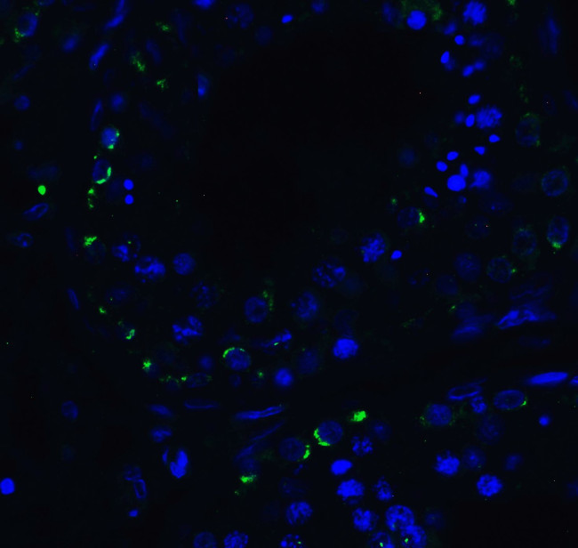 RIG-I Antibody in Immunohistochemistry (IHC)