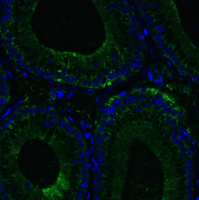 RIG-I Antibody in Immunohistochemistry (IHC)