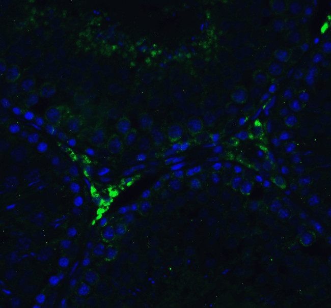 RIG-I Antibody in Immunohistochemistry (IHC)