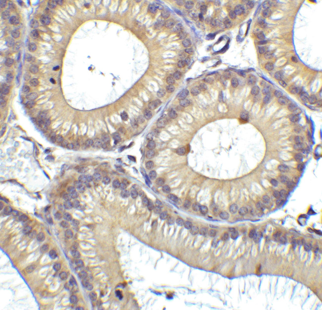 RIG-I Antibody in Immunohistochemistry (IHC)