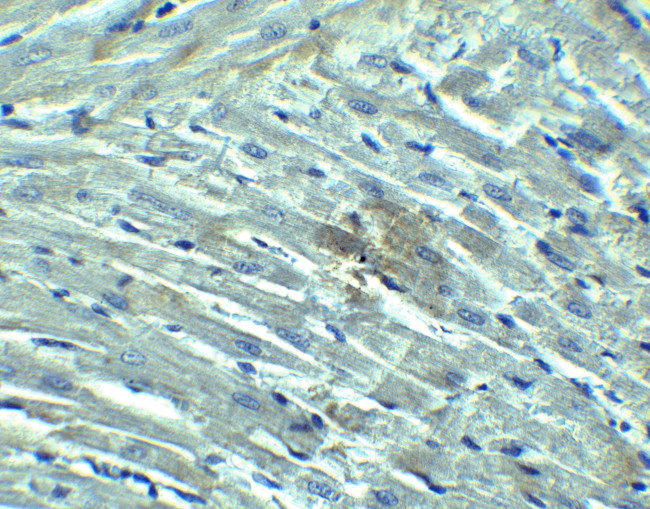 RIG-I Antibody in Immunohistochemistry (IHC)