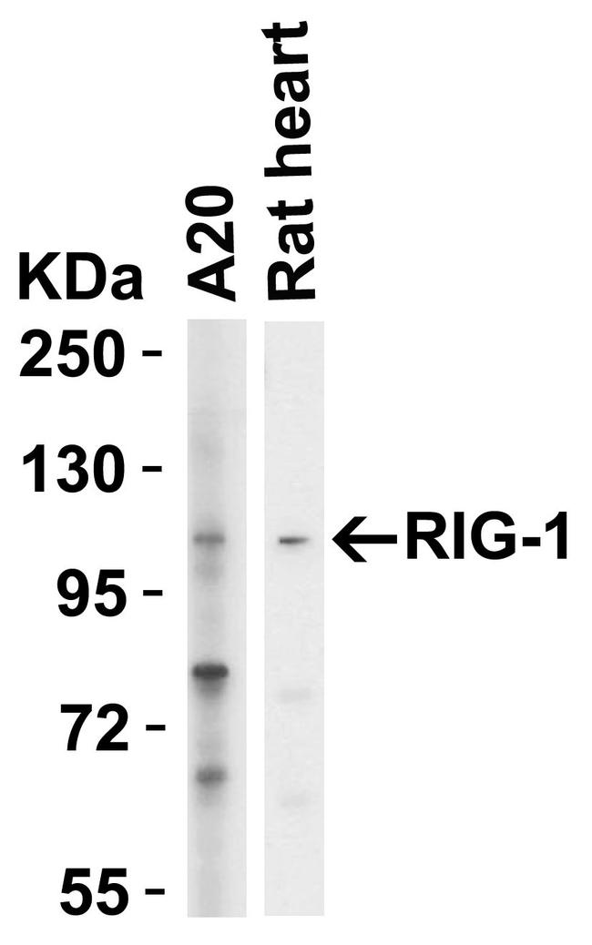 RIG-I Antibody in Western Blot (WB)