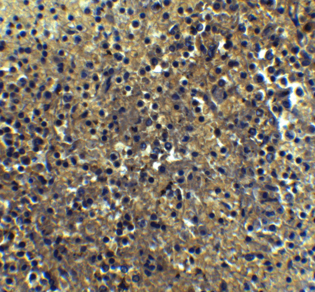 IRF7 Antibody in Immunohistochemistry (IHC)