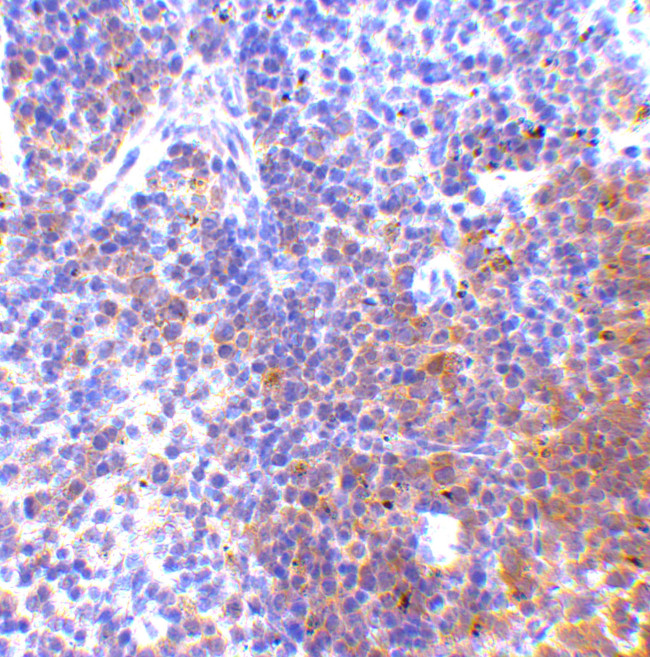 IRF7 Antibody in Immunohistochemistry (IHC)