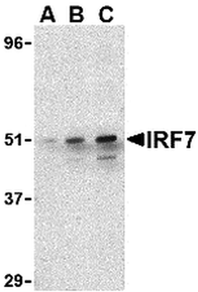 IRF7 Antibody in Western Blot (WB)