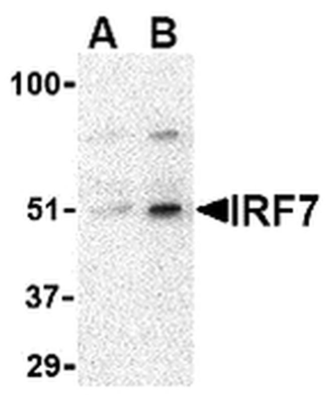 IRF7 Antibody in Western Blot (WB)