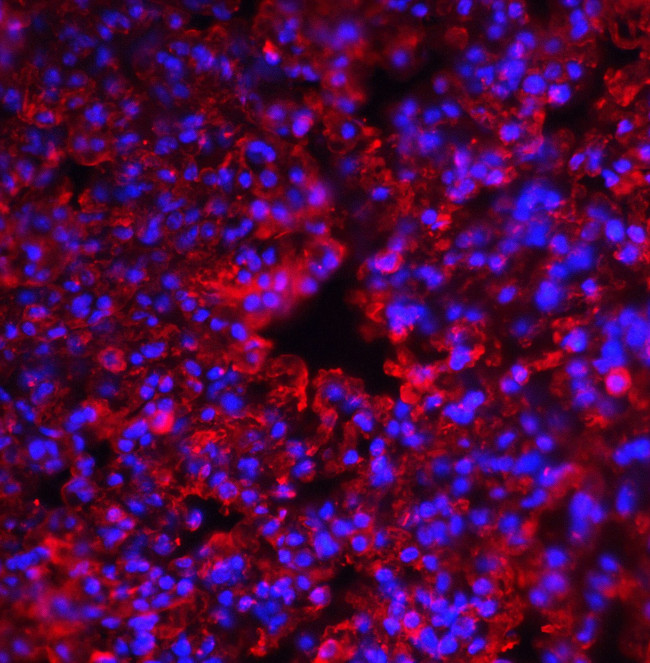 PKR Antibody in Immunohistochemistry (Paraffin) (IHC (P))