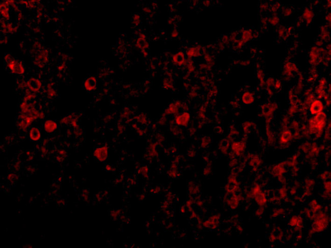 PKR Antibody in Immunohistochemistry (Paraffin) (IHC (P))