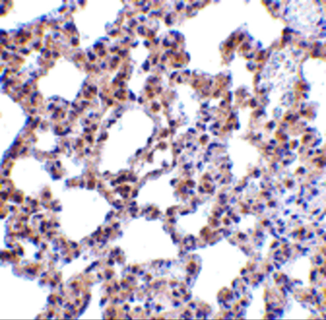 PKR Antibody in Immunohistochemistry (Paraffin) (IHC (P))