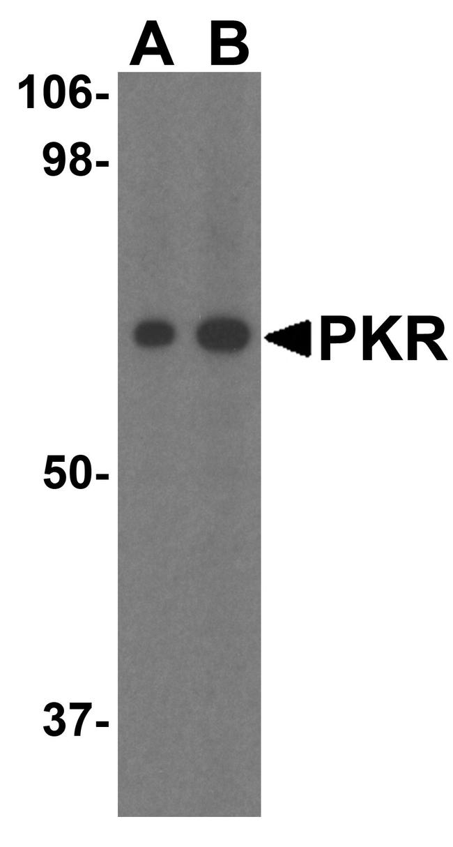 PKR Antibody in Western Blot (WB)