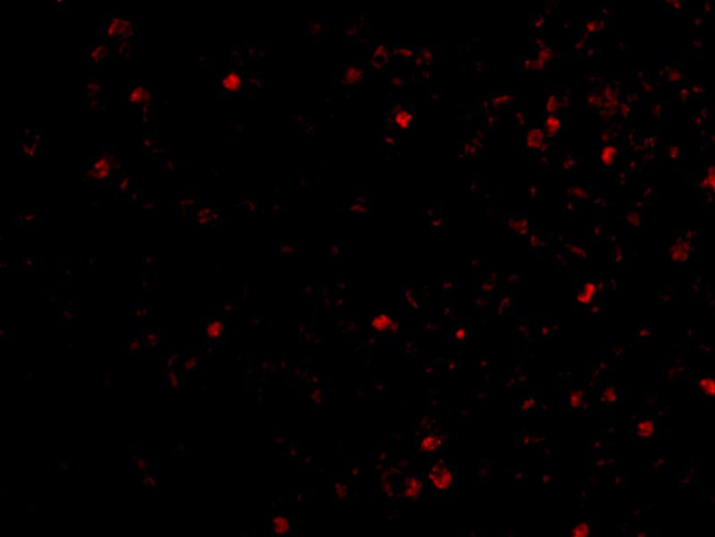 IKAP Antibody in Immunocytochemistry (ICC/IF)