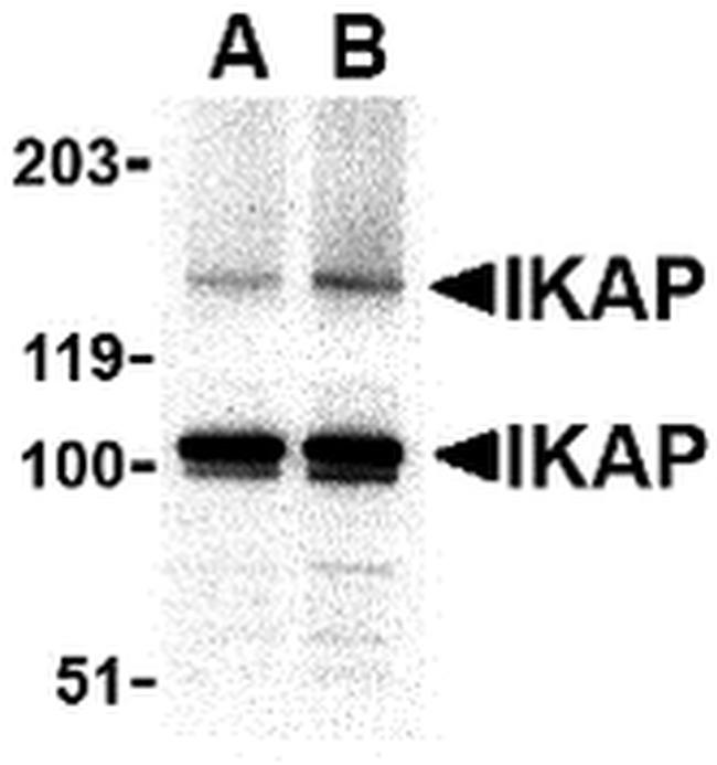 IKAP Antibody in Western Blot (WB)