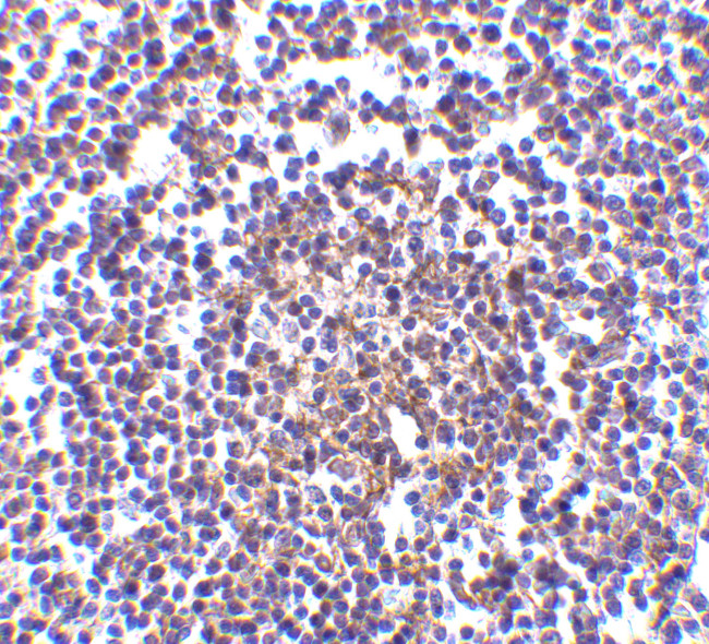 AVEN Antibody in Immunohistochemistry (IHC)