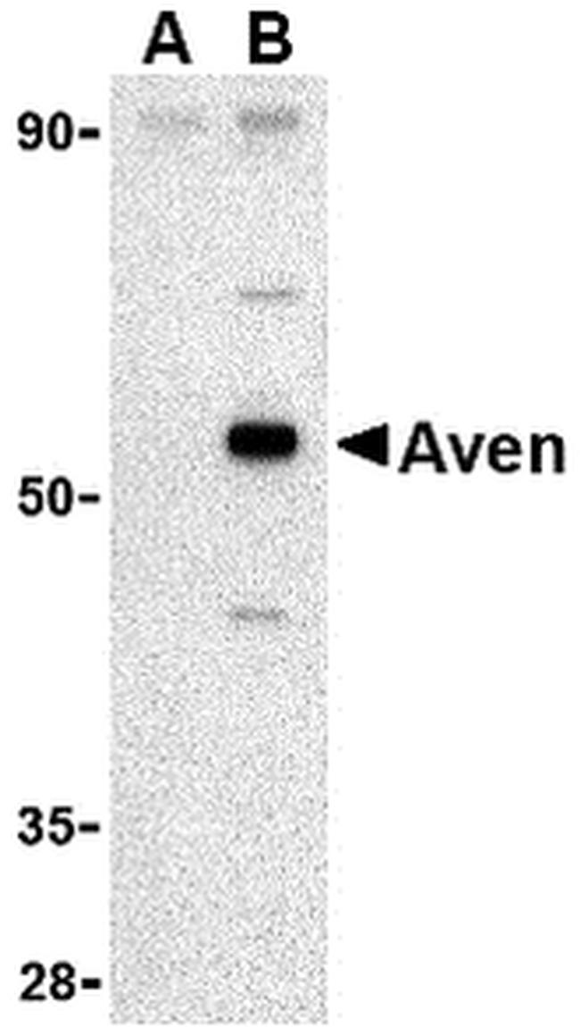 AVEN Antibody in Western Blot (WB)