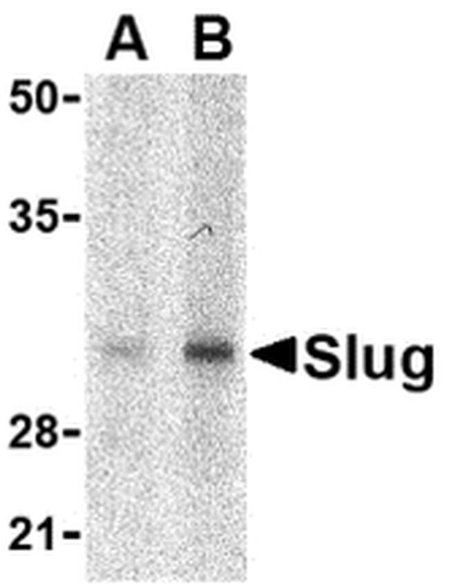 SLUG Antibody in Western Blot (WB)