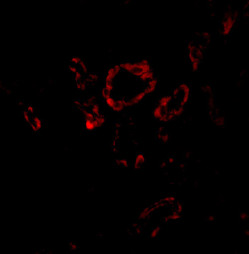 SLUG Antibody in Immunohistochemistry (IHC)