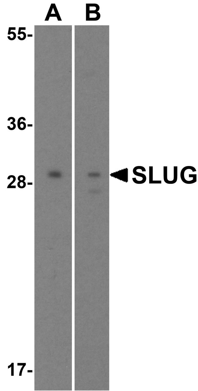 SLUG Antibody in Western Blot (WB)