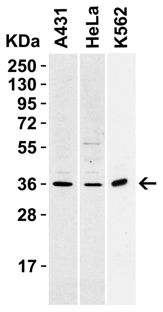 CD254 (RANK Ligand) Antibody in Western Blot (WB)