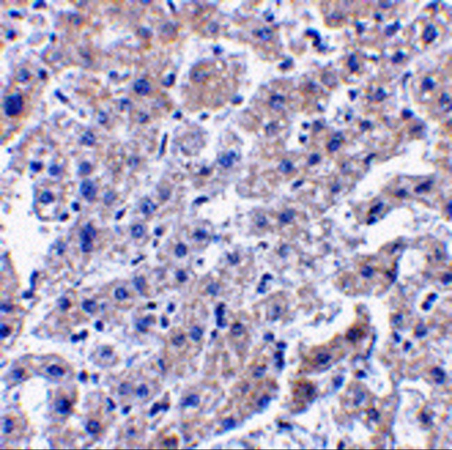 Caspase 14 Antibody in Immunohistochemistry (IHC)