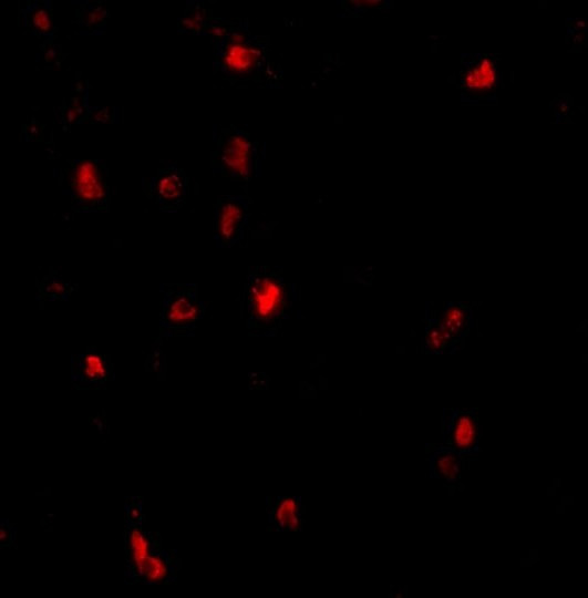 c-Cbl Antibody in Immunohistochemistry (IHC)