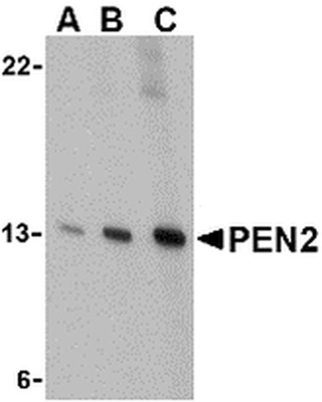 PEN2 Antibody in Western Blot (WB)