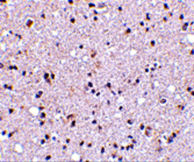 TMP21 Antibody in Immunohistochemistry (IHC)