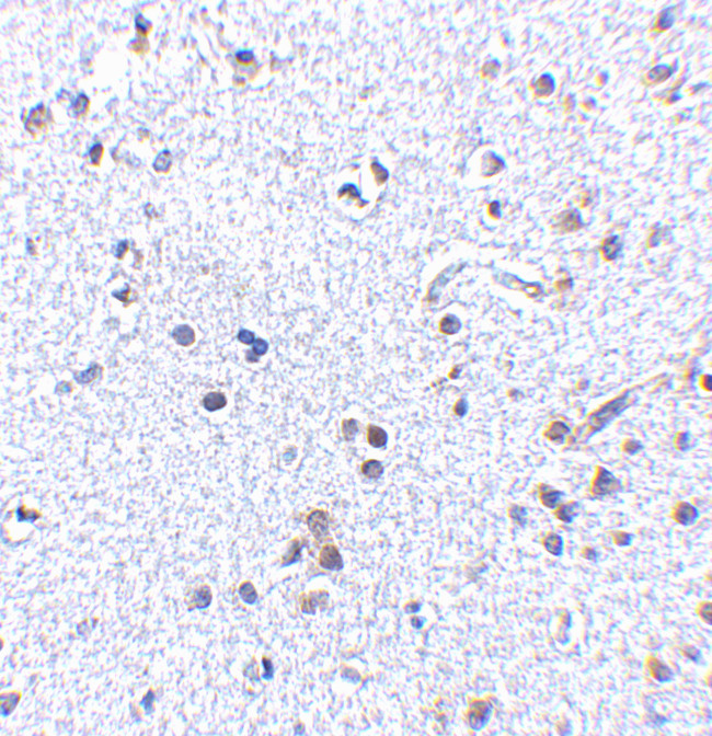 TSLP Antibody in Immunohistochemistry (Paraffin) (IHC (P))