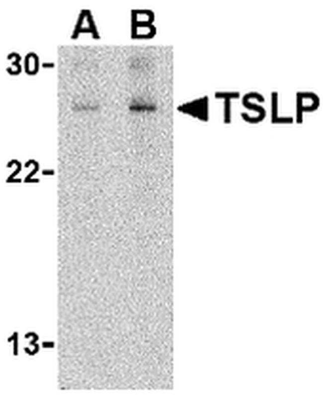 TSLP Antibody in Western Blot (WB)