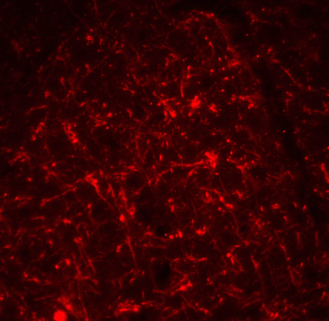 TSLP Antibody in Immunohistochemistry (PFA fixed) (IHC (PFA))