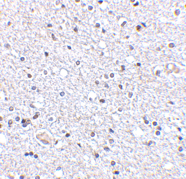 TSLP Antibody in Immunohistochemistry (Paraffin) (IHC (P))