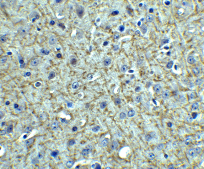 TSLP Antibody in Immunohistochemistry (Paraffin) (IHC (P))