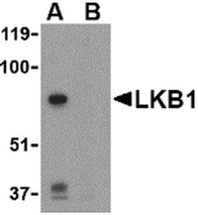 LKB1 Antibody in Western Blot (WB)