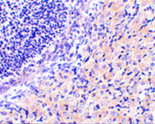 RPAIN Antibody in Immunohistochemistry (IHC)