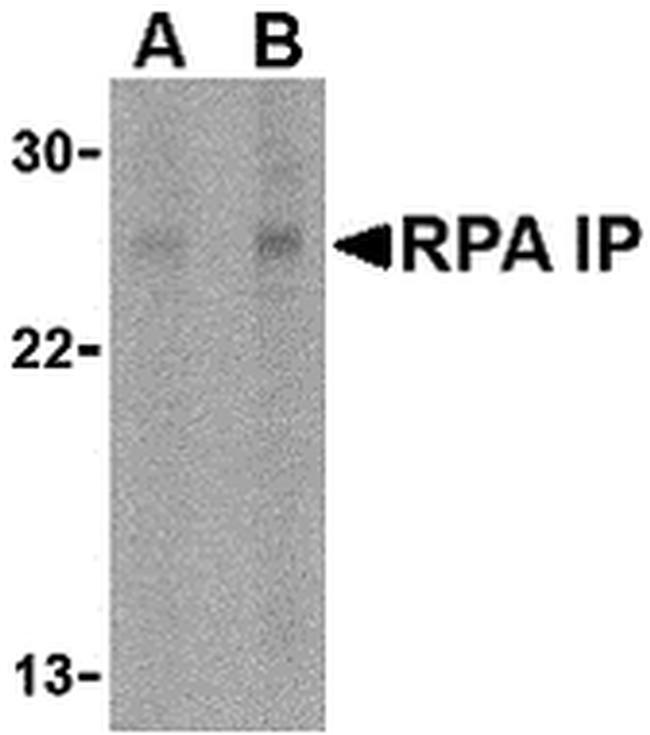 RPAIN Antibody in Western Blot (WB)