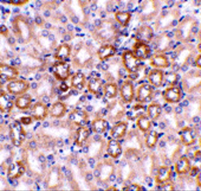 Nephrin Antibody in Immunohistochemistry (Paraffin) (IHC (P))