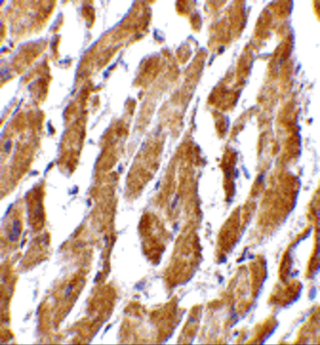 CRTH2 Antibody in Immunohistochemistry (IHC)