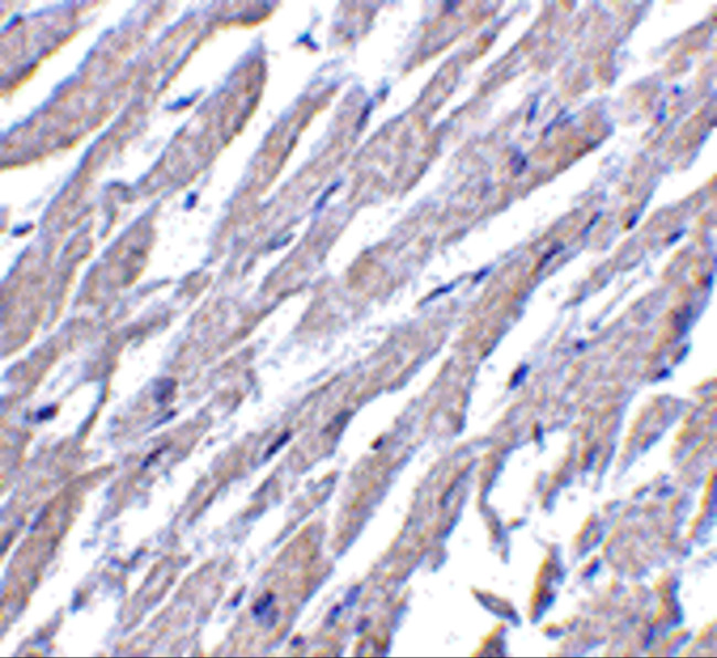 CRTH2 Antibody in Immunohistochemistry (IHC)